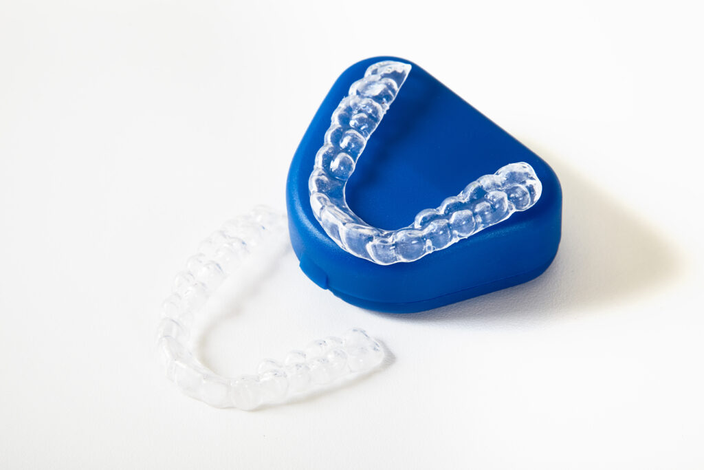 Clear Aligners Cape Town