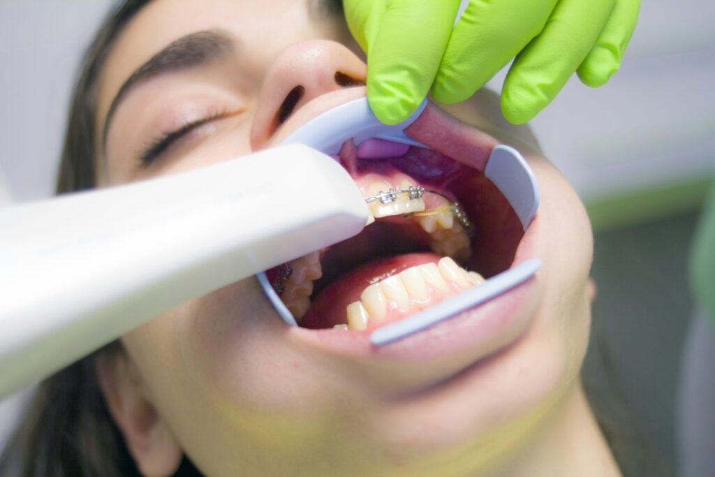 Dental Braces Cape Town