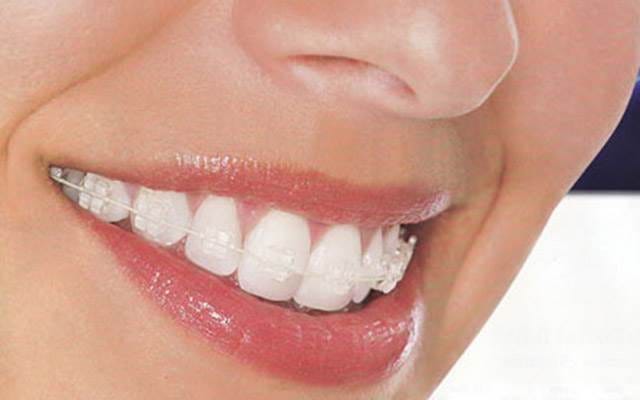 orthodontist in Bergvliet, Cape Town