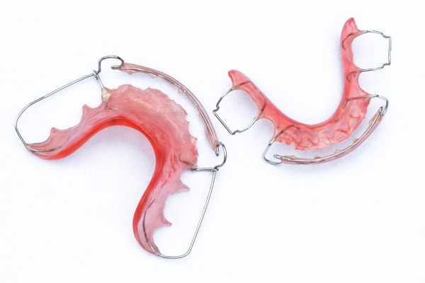 Detachable Appliances, orthodontist Bergvliet, Cape Town