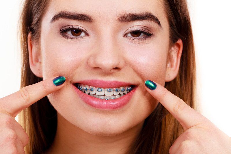 Orthodontic Care in Plumstead